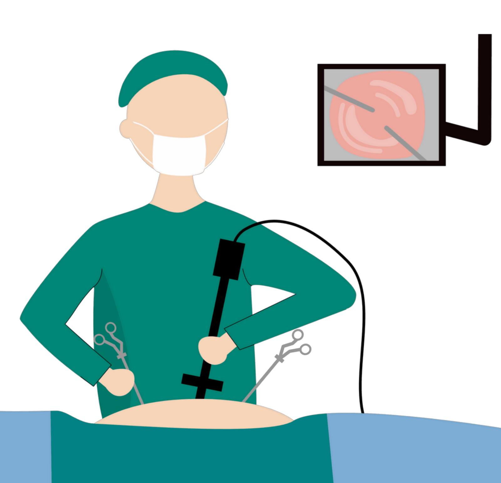 Laparoscopy-Surgery-Simulation-image